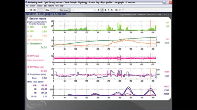 L’applicazione del biofeedback nello sport