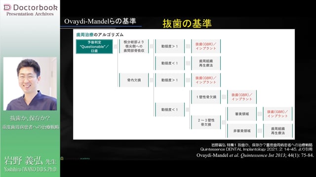 #2  歯根分割症例と抜歯の診断基準