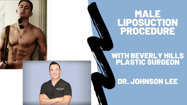 Male Liposuction Procedure Video with Dr. Johnson Lee