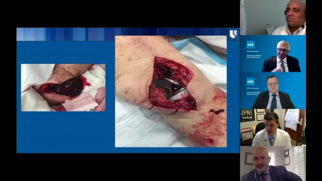 https://i.vimeocdn.com/video/1127870178-361fc4bd7e691cc62c32db082045a3af0f9b712f352255da3d51ae36f21a00b8-d_640x360?r=pad