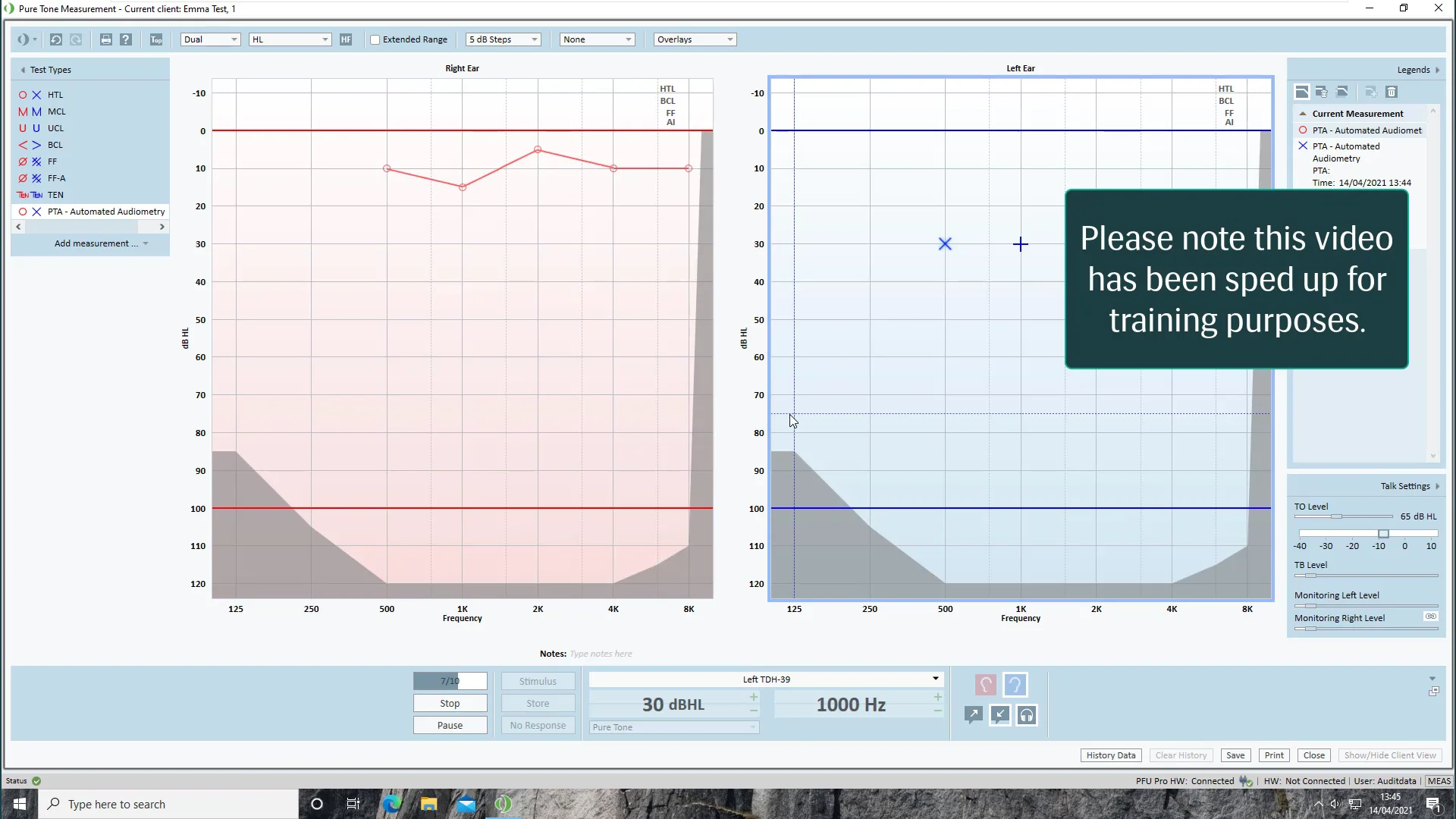 Performing Automated Audiometrymp4 On Vimeo 5517