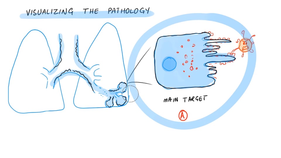 New Technique To Study COVID Pathology (High Parameter Imaging Mass Cytometry)