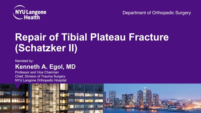 Repair of Tibial Plateau Fracture Schatzker II