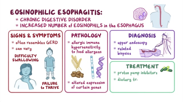 eosinophilic esophagitis