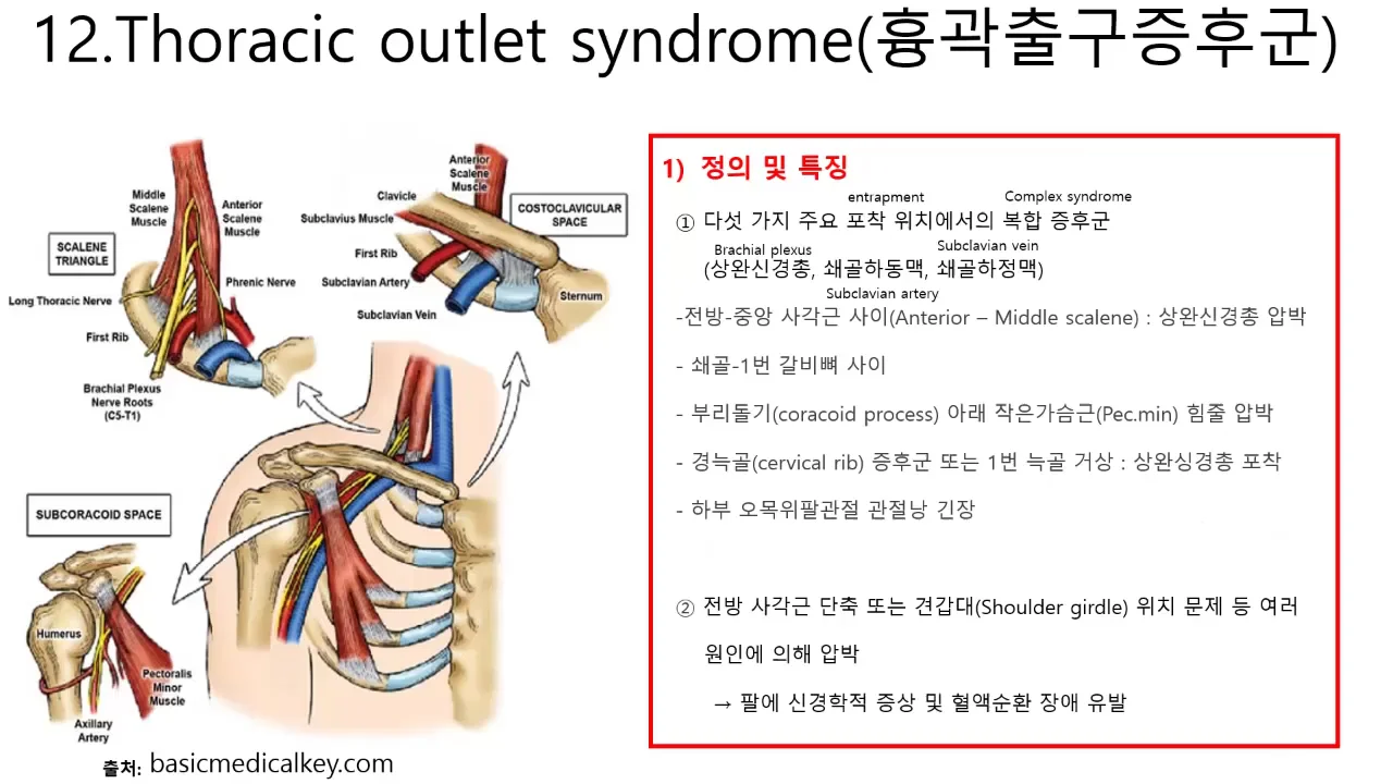 PMA 병리학_12 흉곽출구증후군 on Vimeo