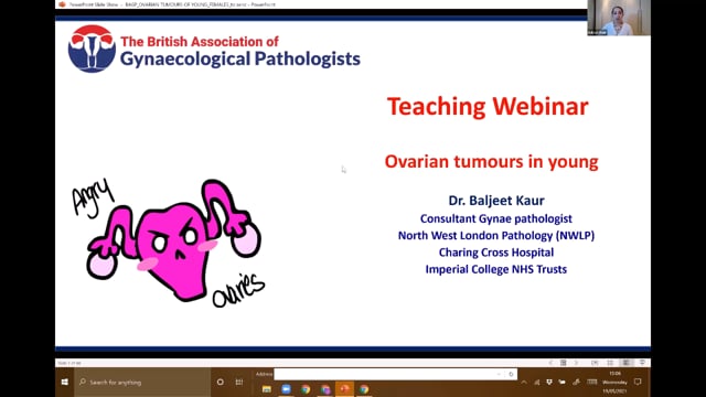 Ovarian Tumours in Young