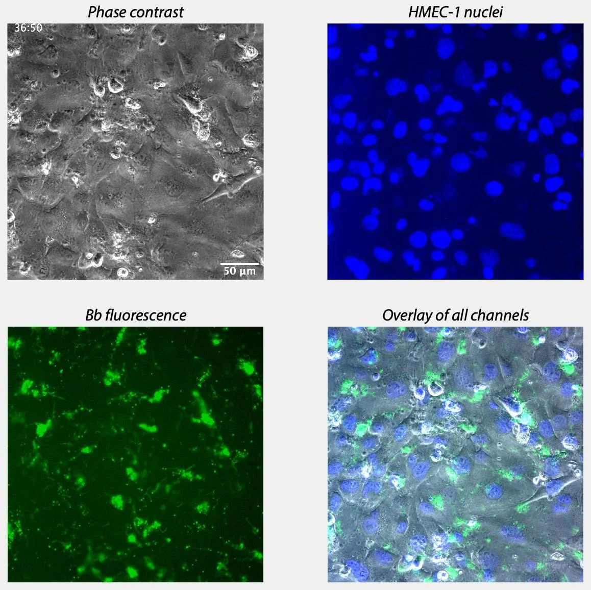 Timelapse movie of endothelial cells (HMEC-1) in monolayer exposed to ...