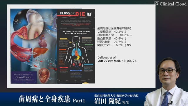 歯周病と全身疾患 Part1