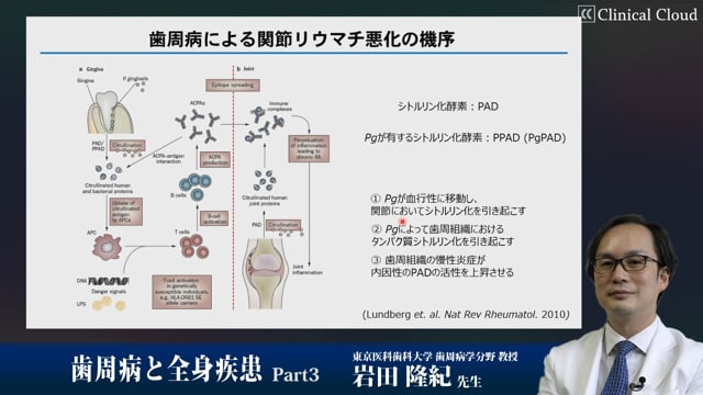 歯周病と全身疾患 Part3