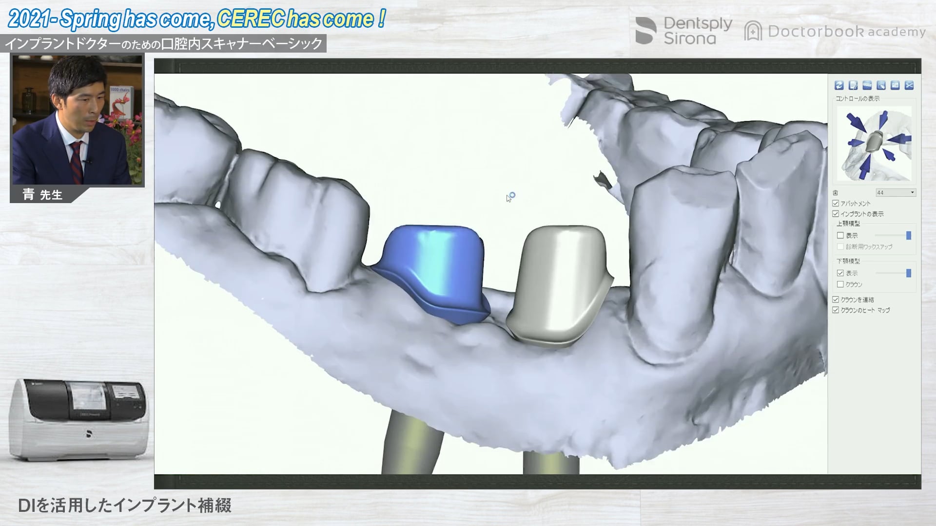 【特別無料公開】2021‐Spring has come, CEREC has come！ インプラントドクターのための口腔内スキャナーベーシック：後編