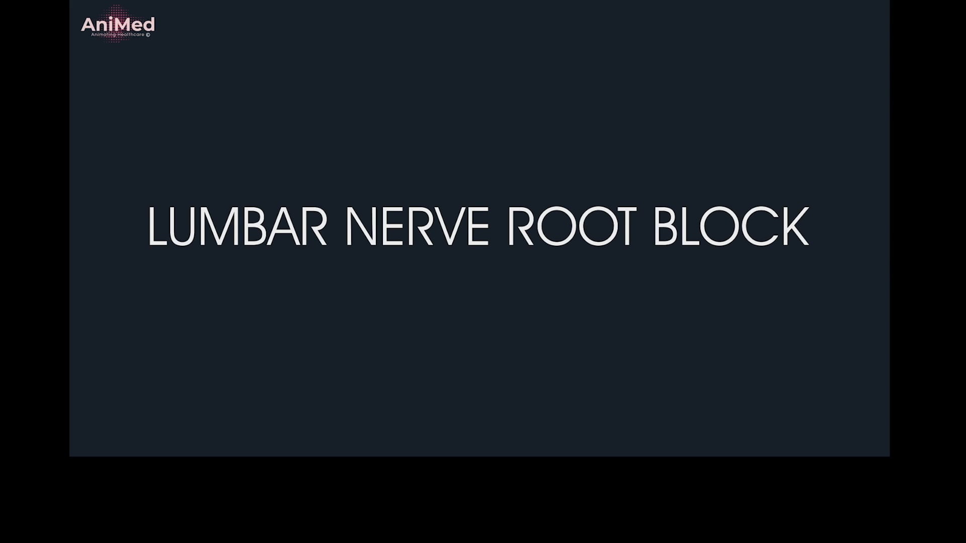 Lumbar Nerve Root Block