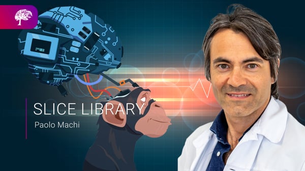 LIBRARY - P.MACHI - Artificial intelligence in ischemic stroke and neurointervention perspective