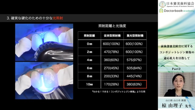 コンポジットレジン修復の効率UP 短い時間で・無駄なく・ミス