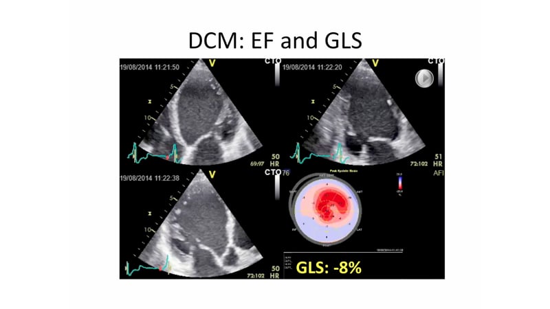 What is the prognostic value of STE?