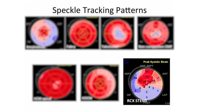 What patterns can I find with STE?