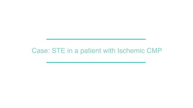 Case: STE in a patient with Ischemic CMP