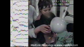 Eyelid myoclonia and absences in a 4-year-old boy (video-EEG)