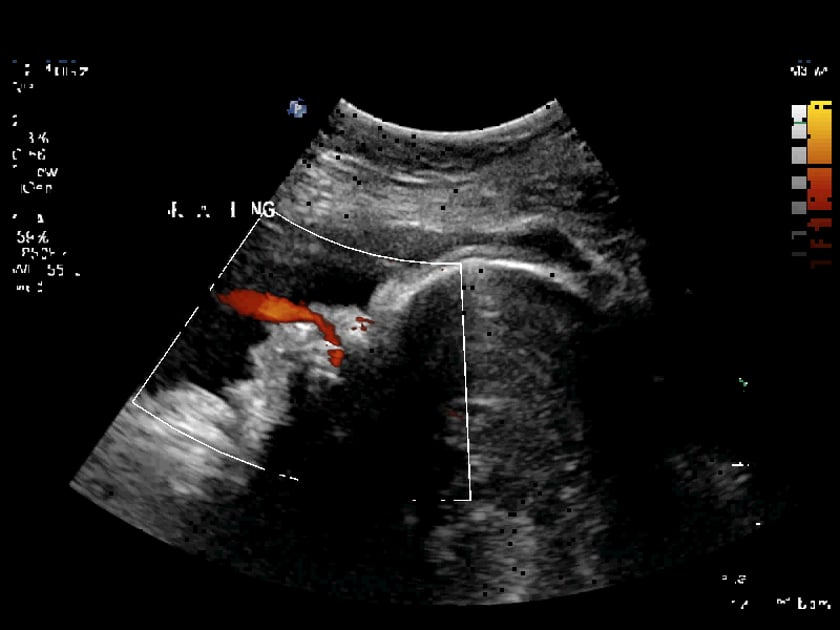 3rd trimester normal – ULTRASOUNDPAEDIA