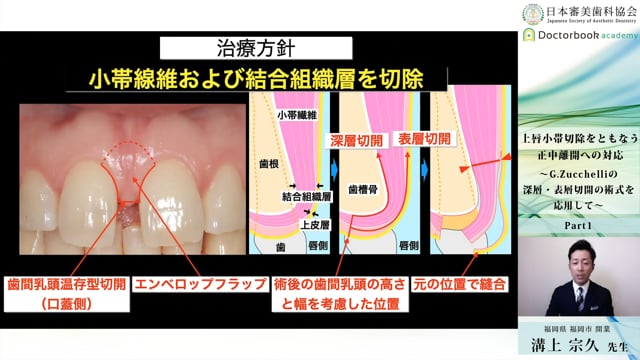 日本審美歯科協会 WEB講演会 | Doctorbook academy (ドクターブック 