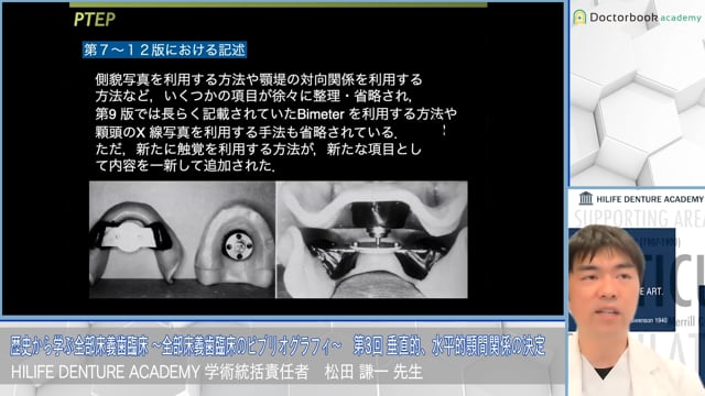 垂直的、水平的顎間関係の決定│歴史から学ぶ全部床義歯臨床 〜全部床義歯臨床のビブリオグラフィ〜 第3回 