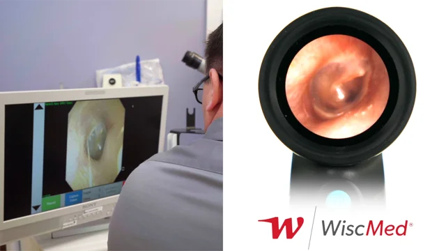 Wispr Digital Otoscope for Medical Professionals