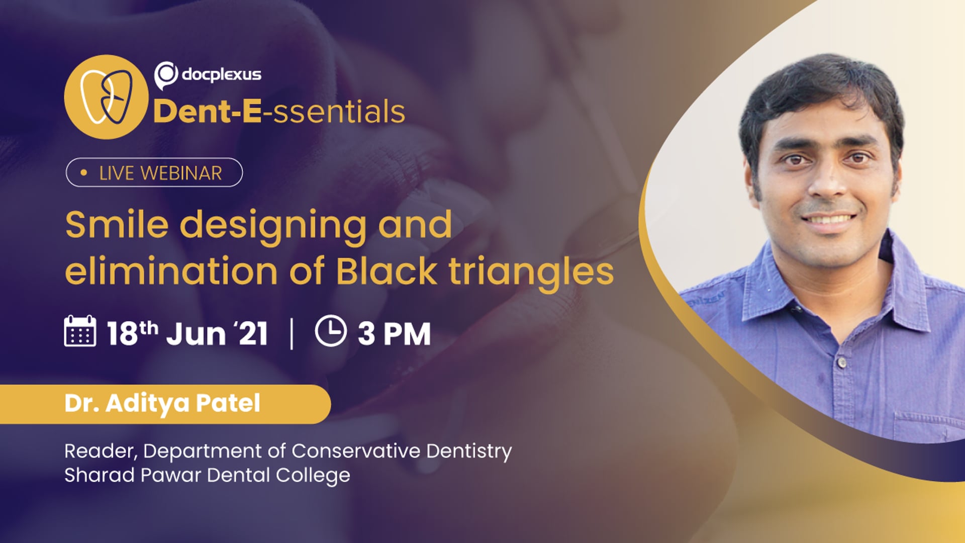 Smile Designing and Elimination of Black Triangles