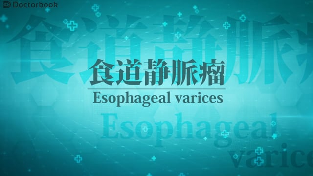 食道静脈瘤と原因や症状は？診断に必要な検査と治療適応