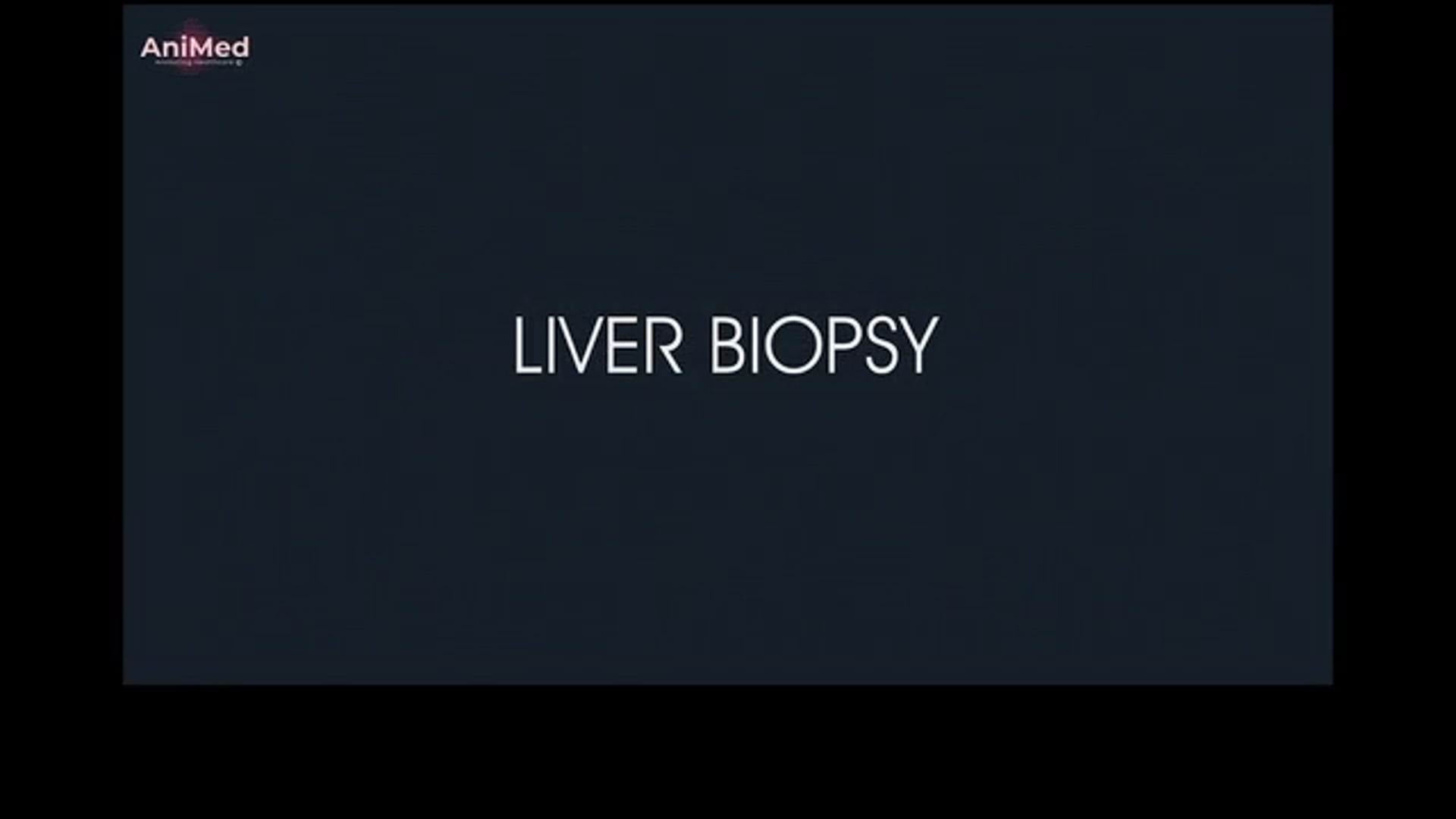 Liver Biopsy Patient Info