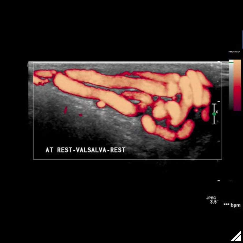 ultrasoundpaedia – Page 2 – ULTRASOUNDPAEDIA