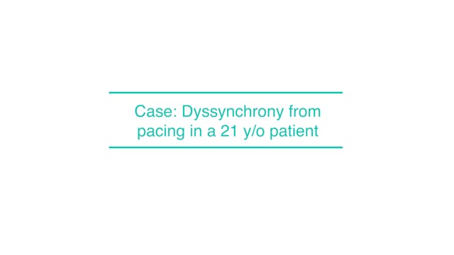 Case: Dyssynchrony from pacing in a 21 y/o patient