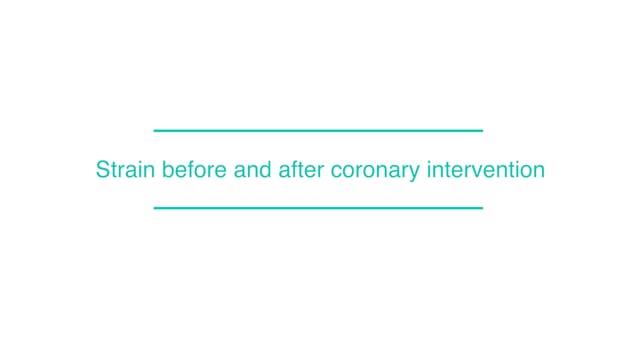 Strain before and after coronary intervention