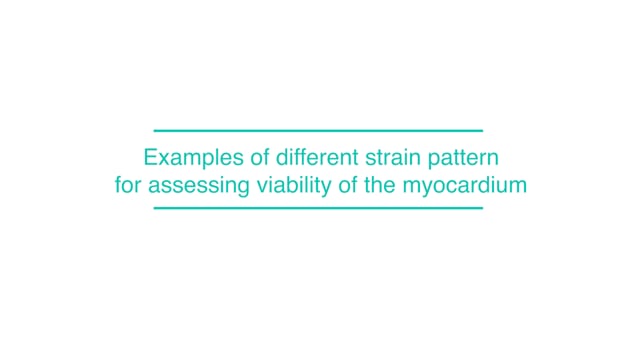 Examples of different strain pattern for assessing viability of the myocardium