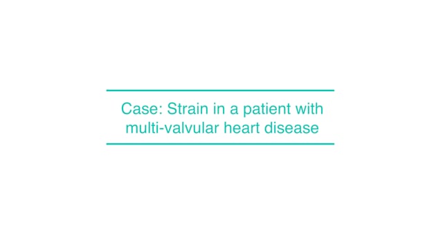 Case: Strain in a patient with multi-valvular heart disease