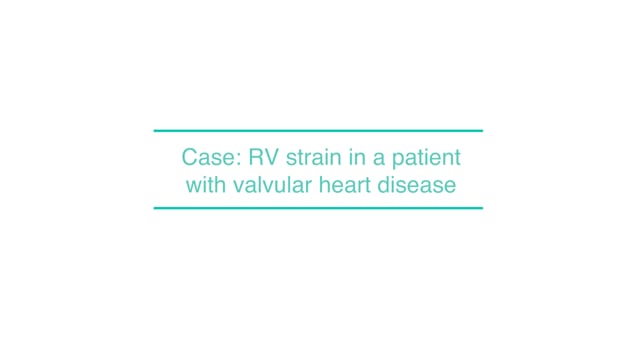 Case: RV strain in a patient with valvular heart disease