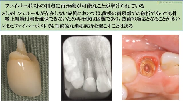 #1 論文からの研究結果