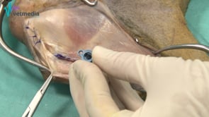 TTA : Avance de la Tuberosidad Tibial
