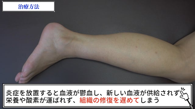 症例別『腓骨骨折』