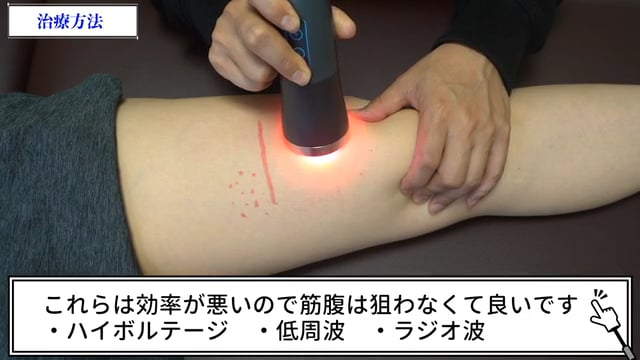 症例別『肉離れ(大腿四頭筋)』