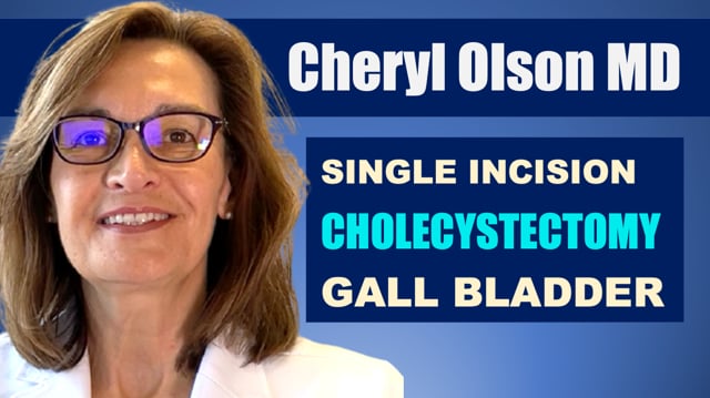 Single Incision Robotic Cholecystectomy - Gall Bladder Removal San DIego, Scripps