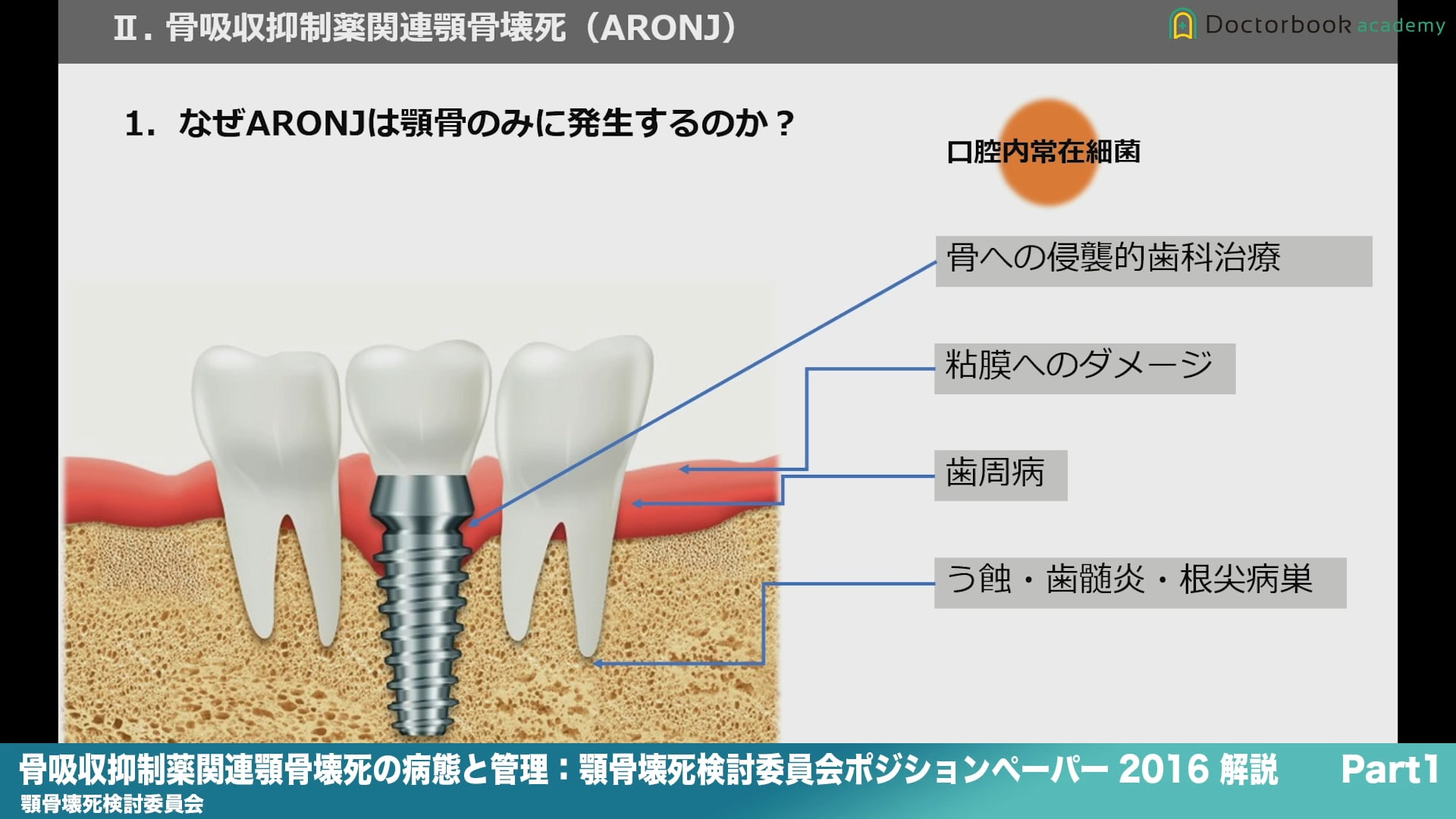 『骨吸収抑制薬関連顎骨壊死の病態と管理：顎骨壊死検討委員会ポジションペーパー 2016』解説 Part1