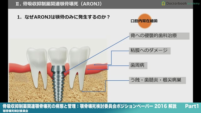 ポイント解説『骨吸収抑制薬関連顎骨壊死の病態と管理：顎骨壊死検討委員会ポジションペーパー 2016』