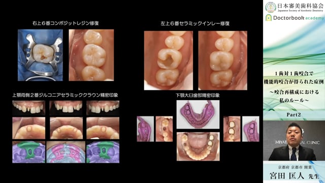 #2 機能咬合における治療目標