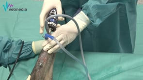 Artroscopia de rodilla - Exploración básica