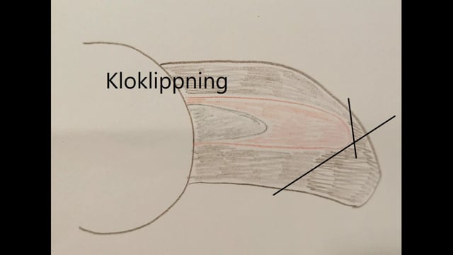 Kloklippning på ett enkelt och säkert sätt