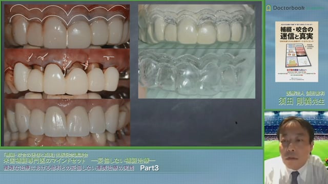 #3 前歯部の審美回復希望の症例