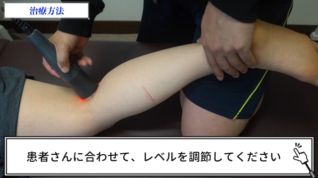 症例別『肉離れ(腓腹筋)』
