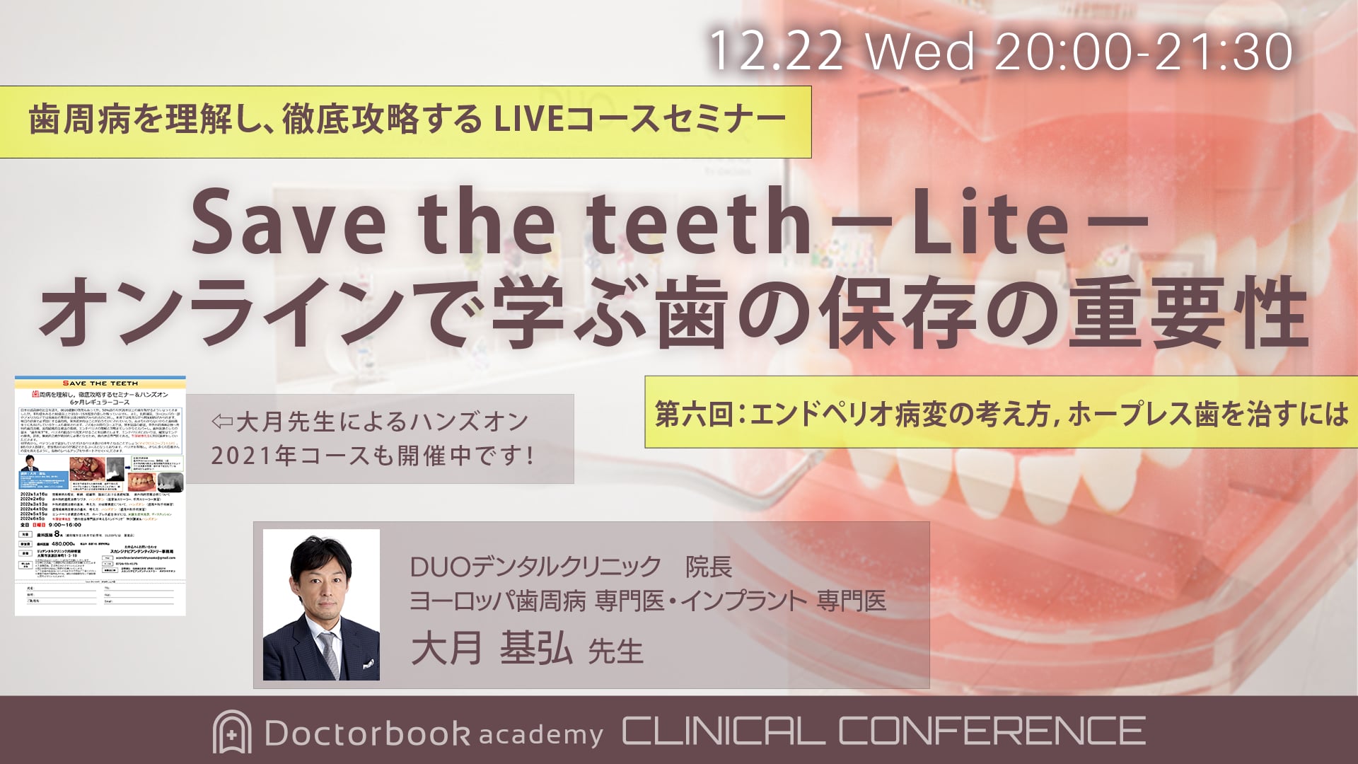 Save the teeth−Lite−オンラインで学ぶ歯の保存の重要性 「 第6回：エンドペリオ病変の考え方，ホープレス歯を治すには」