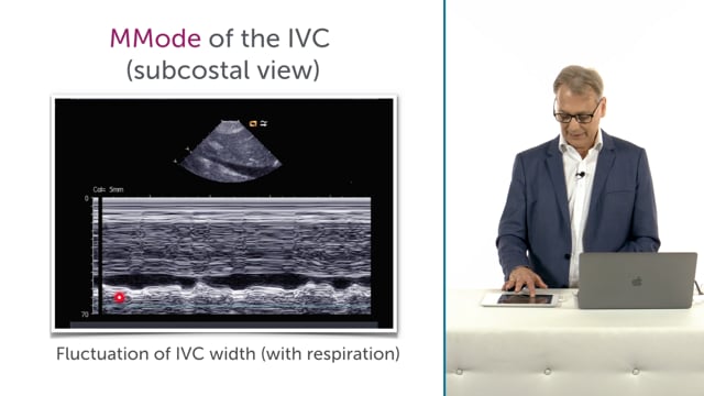How can I assess the IVC with echo?