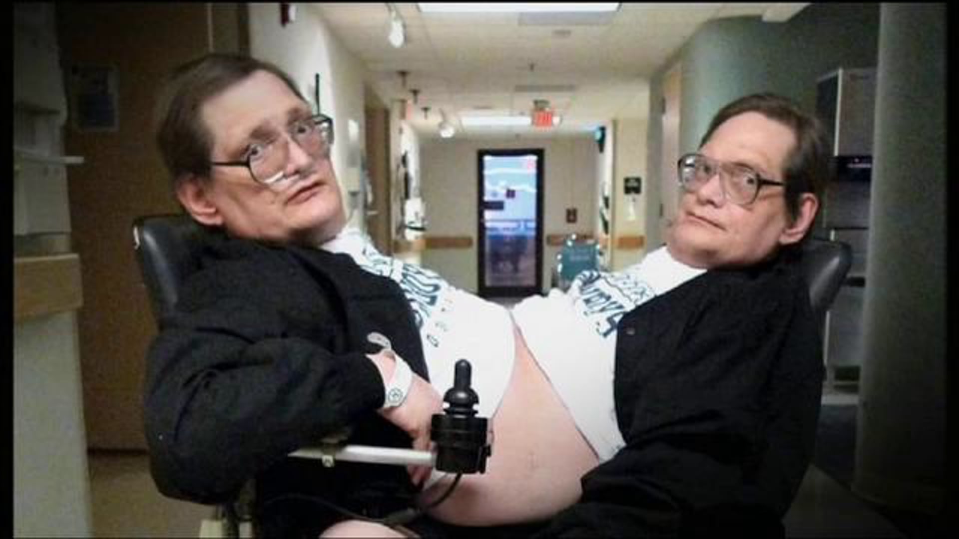 The World's Oldest Conjoined Twins Move Home