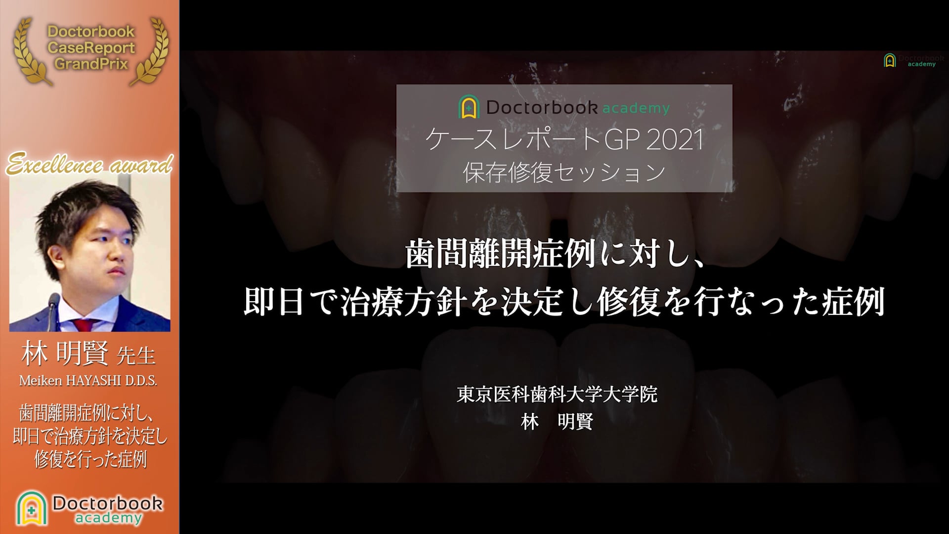 【第4回ケースレポートGP 優秀発表賞】林 明賢先生「歯間離開症例に対し、即日で治療方針を決定し修復を行なった症例」